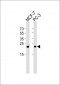 PSMD10 Antibody (Center)